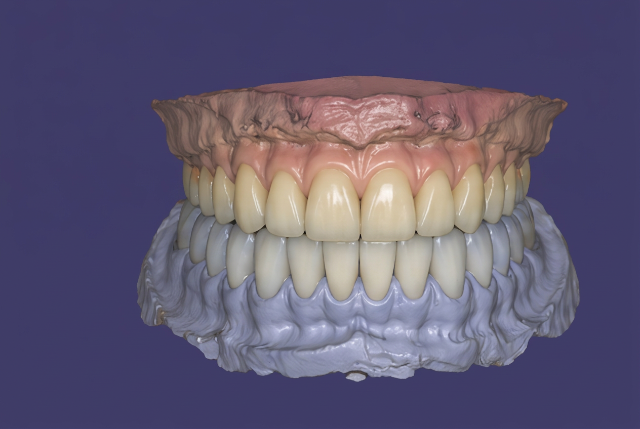 All-on-X occlusion check against the opposing arch