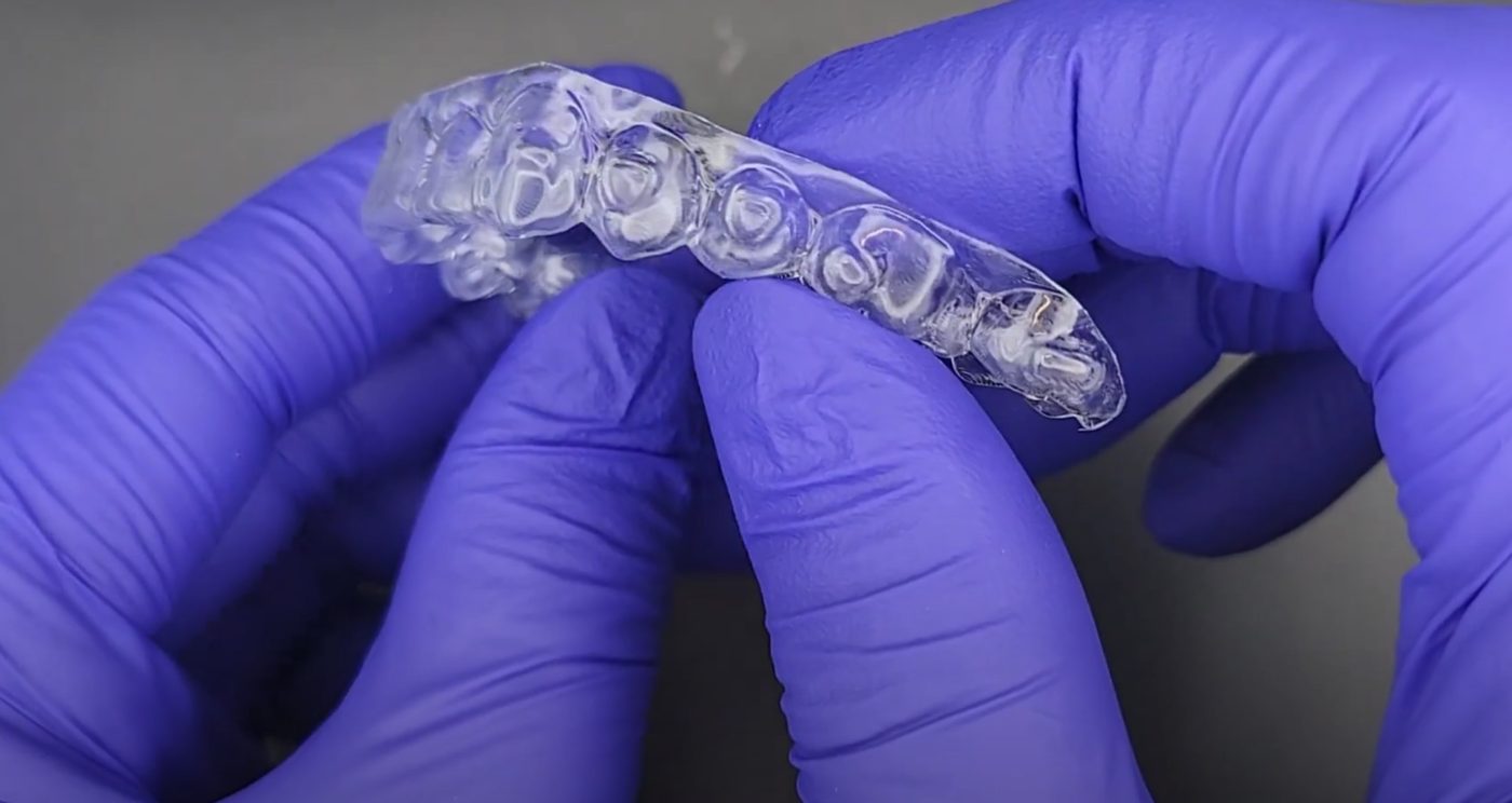 Clear Aligners CAD design – real design case 5
