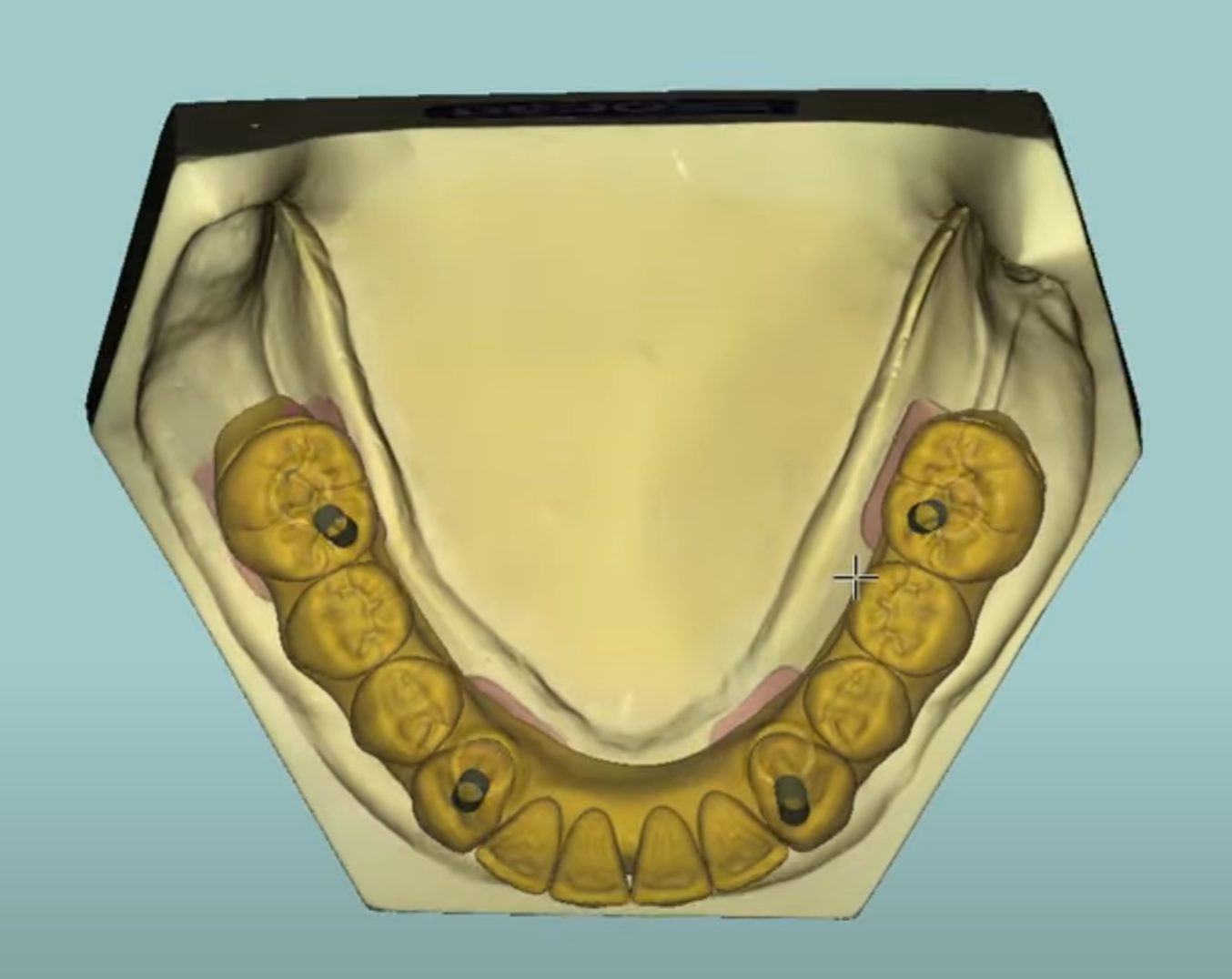 Blender & Full Arch CAD design – real design case 7