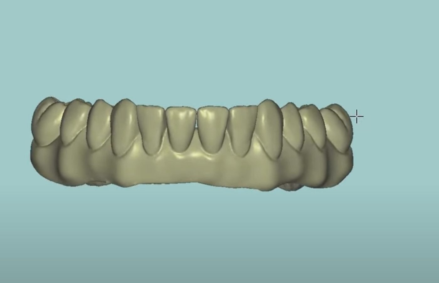 Blender & Full Arch CAD design – real design case 8