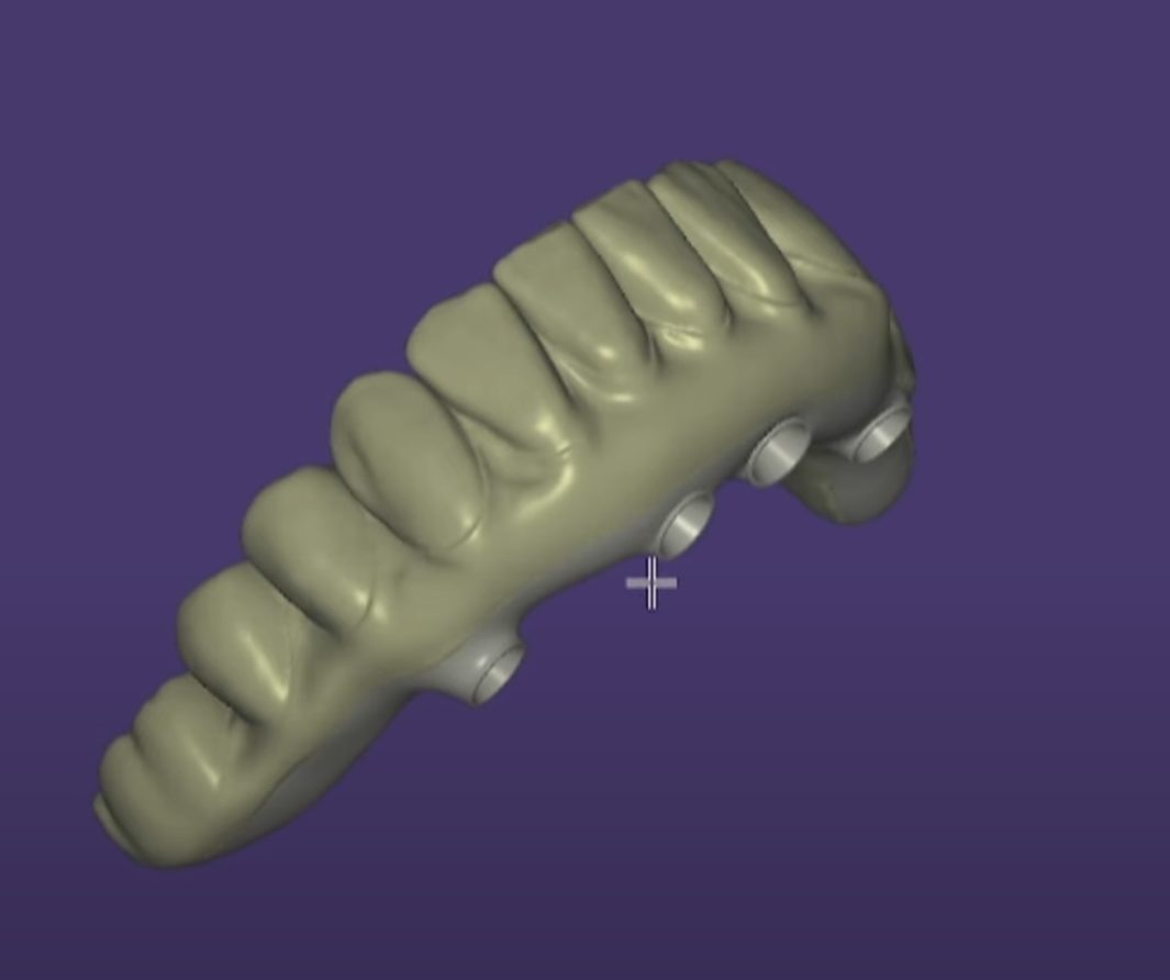Production-ready STL of a full arch All-on-X restoration