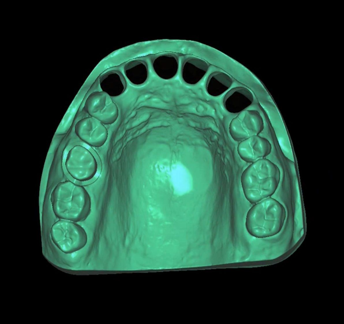 Prepared Teeth CAD design – real design case 6